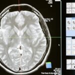brain-getting-smaller