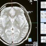 brain