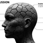 Post-Concussion Syndrome