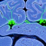 Adult Neurogenesis