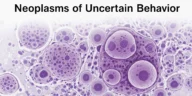 Neoplasms of Uncertain Behavior